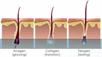 Hair Growth Phases for Laser Hair Removal